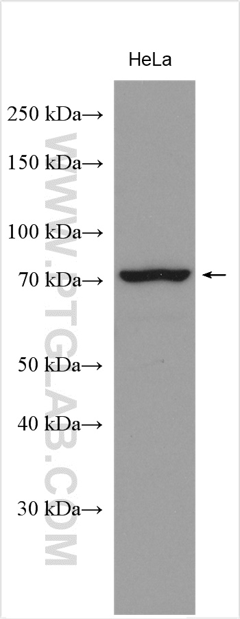 WB analysis using 28413-1-AP