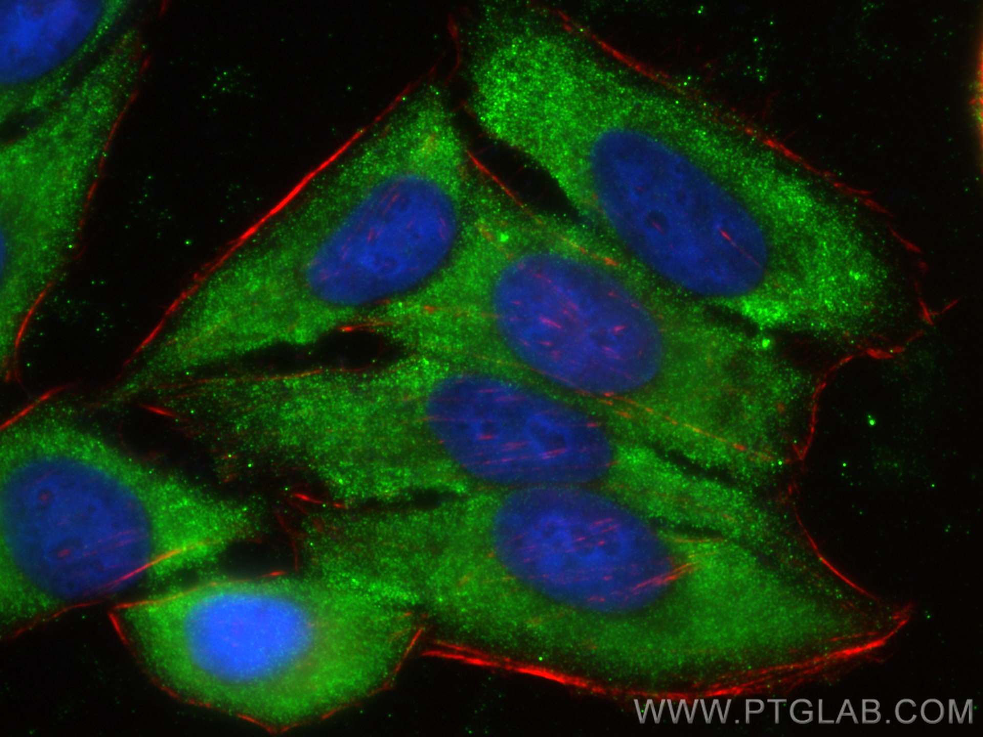 IF Staining of HepG2 using 81760-1-RR