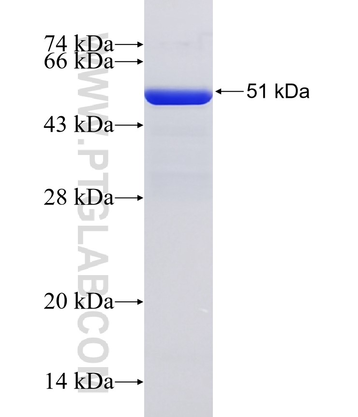 ATG7 fusion protein Ag29159 SDS-PAGE ATG7 fusion protein Ag29159 SDS-PAGE