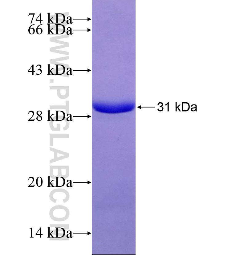 ATG7 fusion protein Ag29172 SDS-PAGE