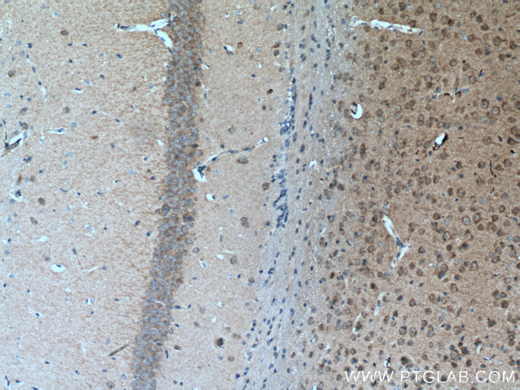 IHC staining of mouse brain using 11010-1-AP