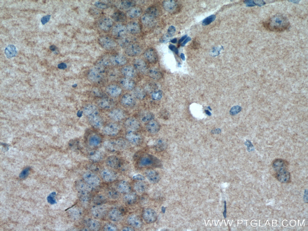 IHC staining of mouse brain using 11010-1-AP