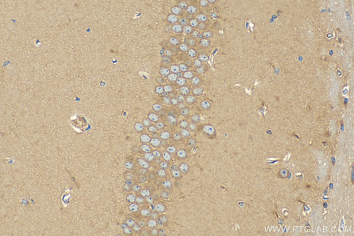 IHC staining of mouse brain using 11010-1-AP