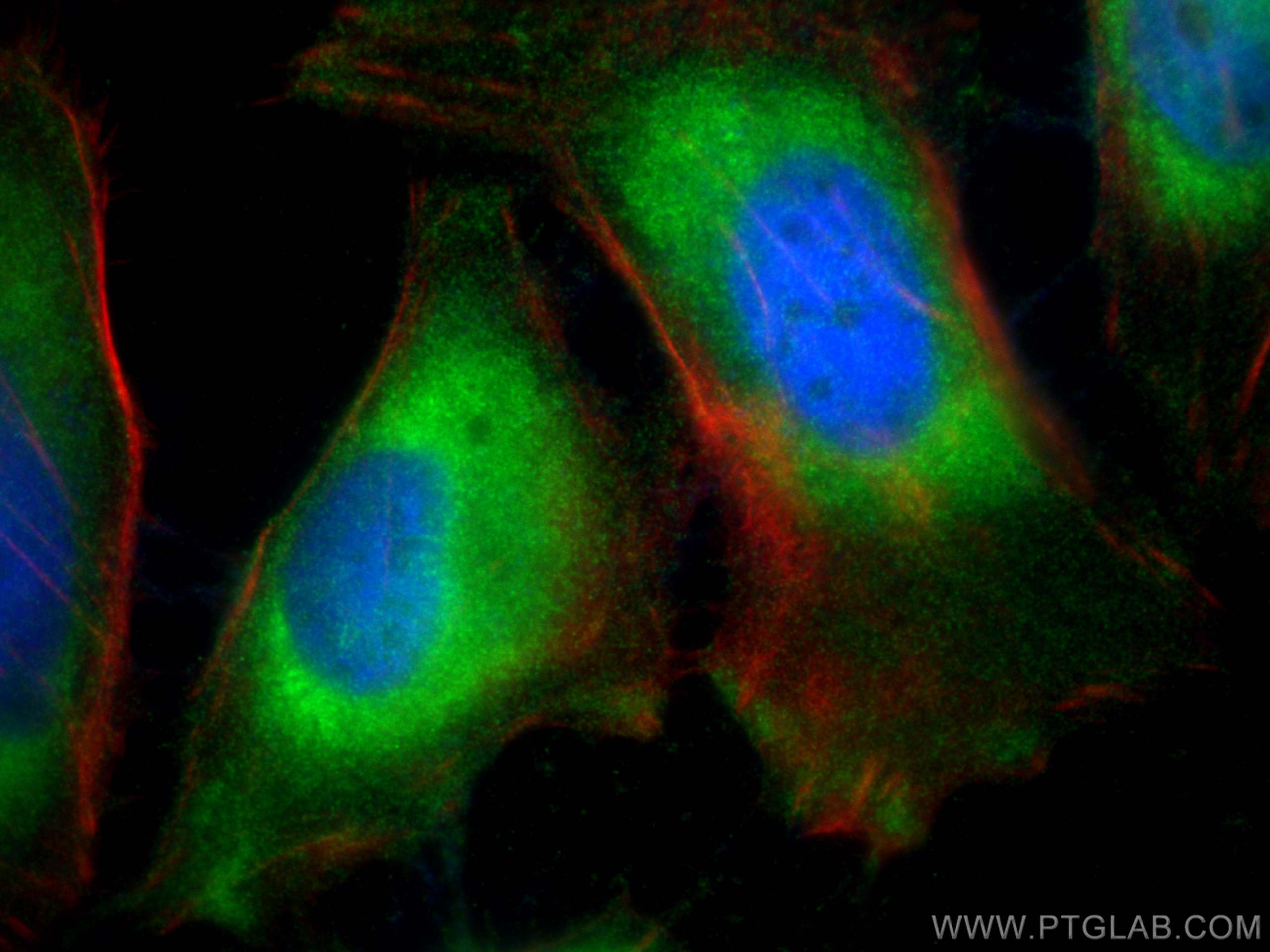 IF Staining of HeLa using 10726-1-AP