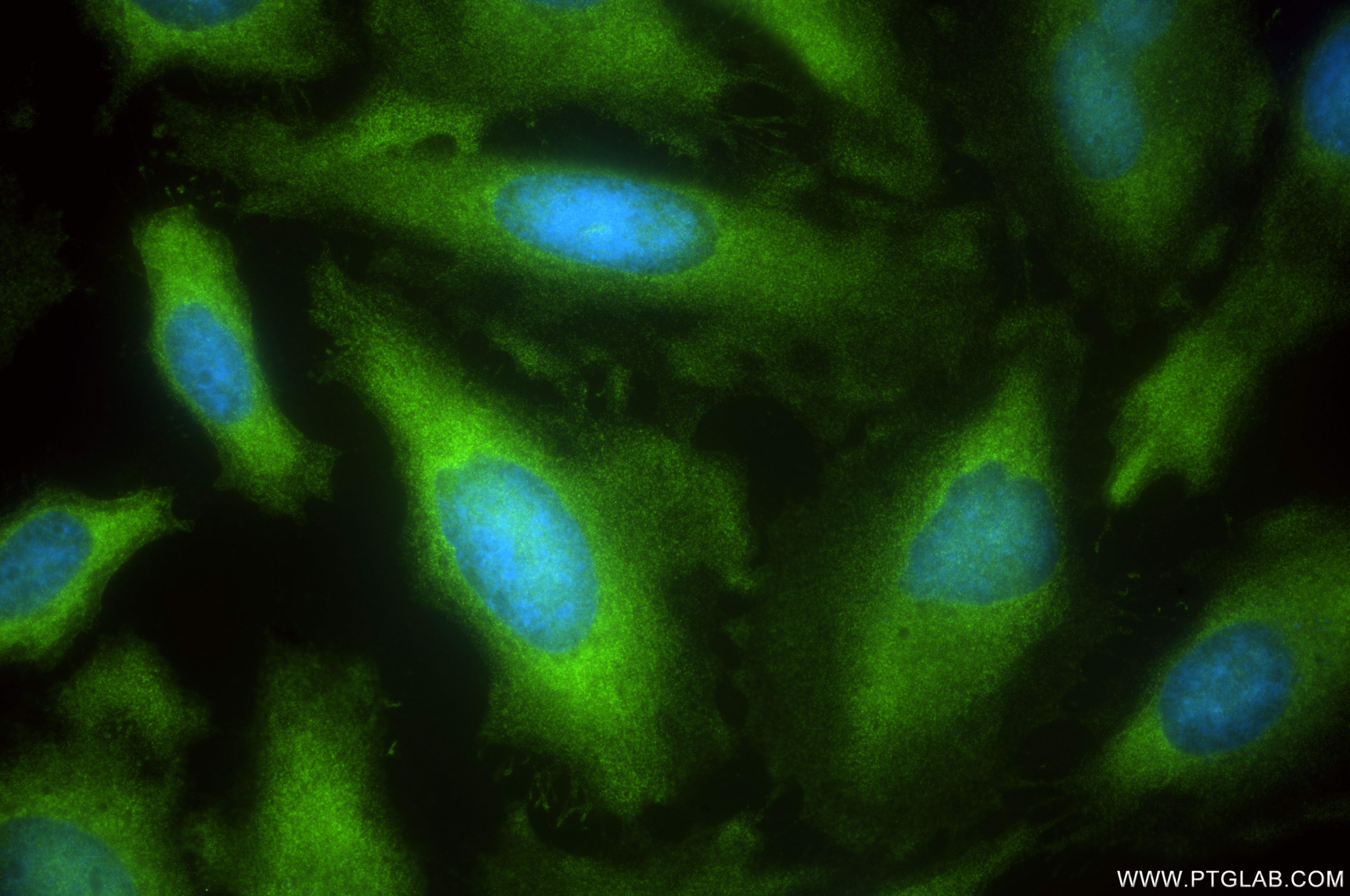 IF Staining of HeLa using 84798-5-RR (same clone as 84798-5-PBS)