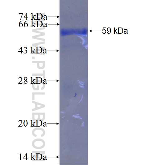 ATIC fusion protein Ag1052 SDS-PAGE