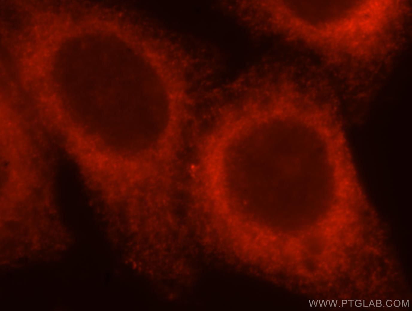 IF Staining of HepG2 using 16921-1-AP