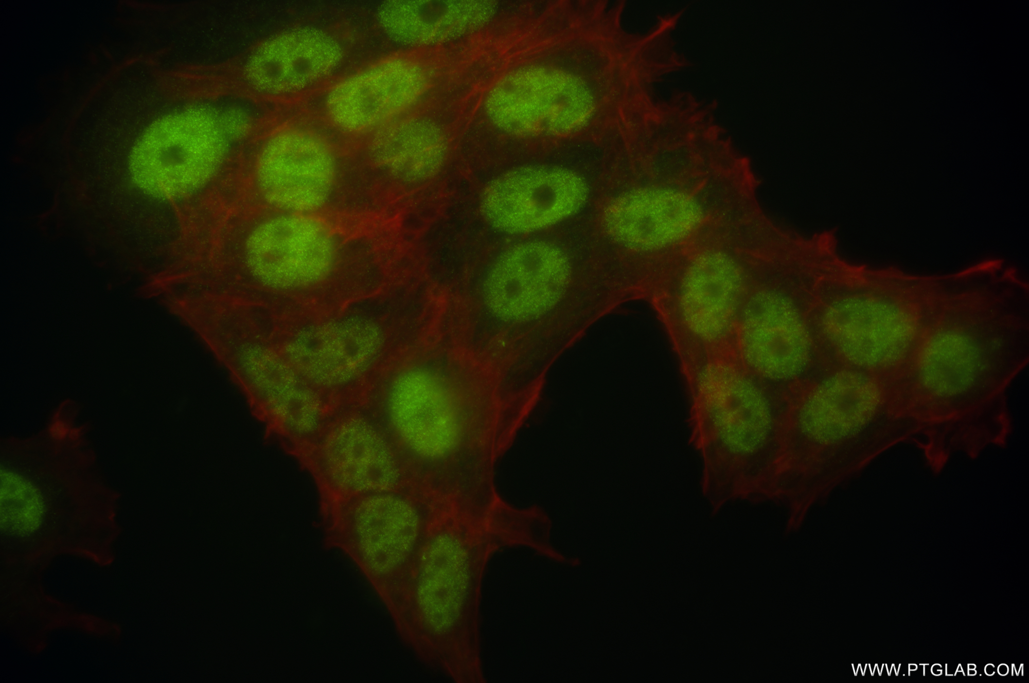 IF Staining of MCF-7 using 83608-5-RR (same clone as 83608-5-PBS)