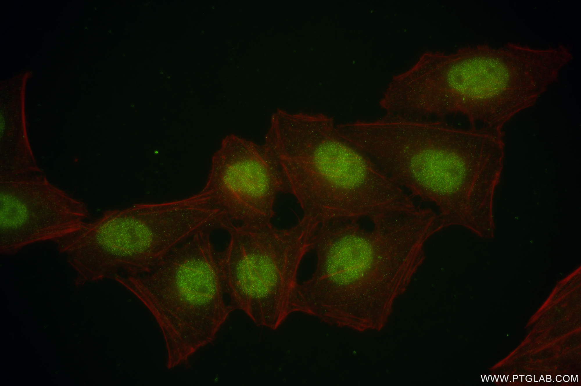 IF Staining of HepG2 using 83608-5-RR (same clone as 83608-5-PBS)