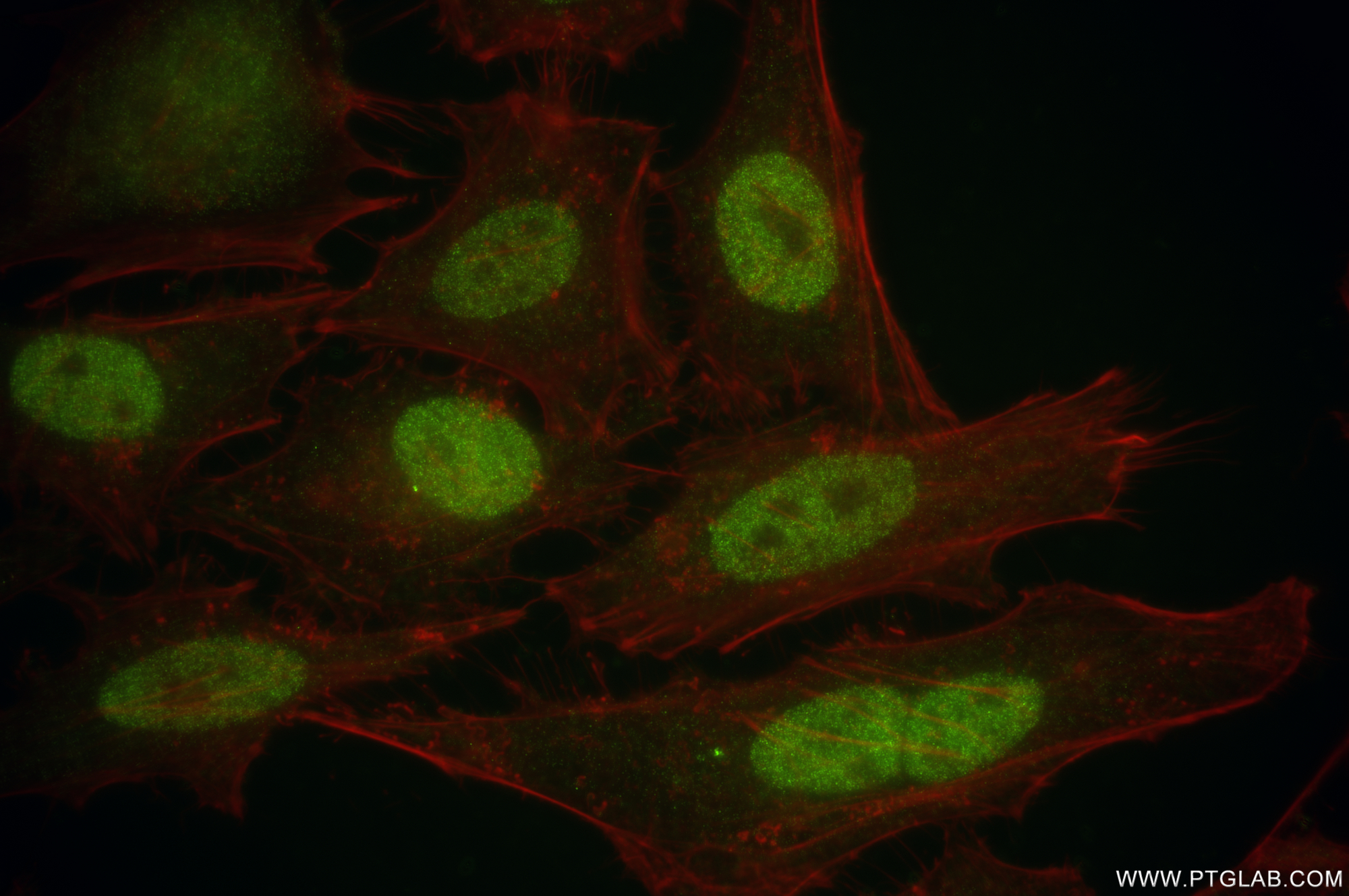 IF Staining of HeLa using 83608-5-RR (same clone as 83608-5-PBS)