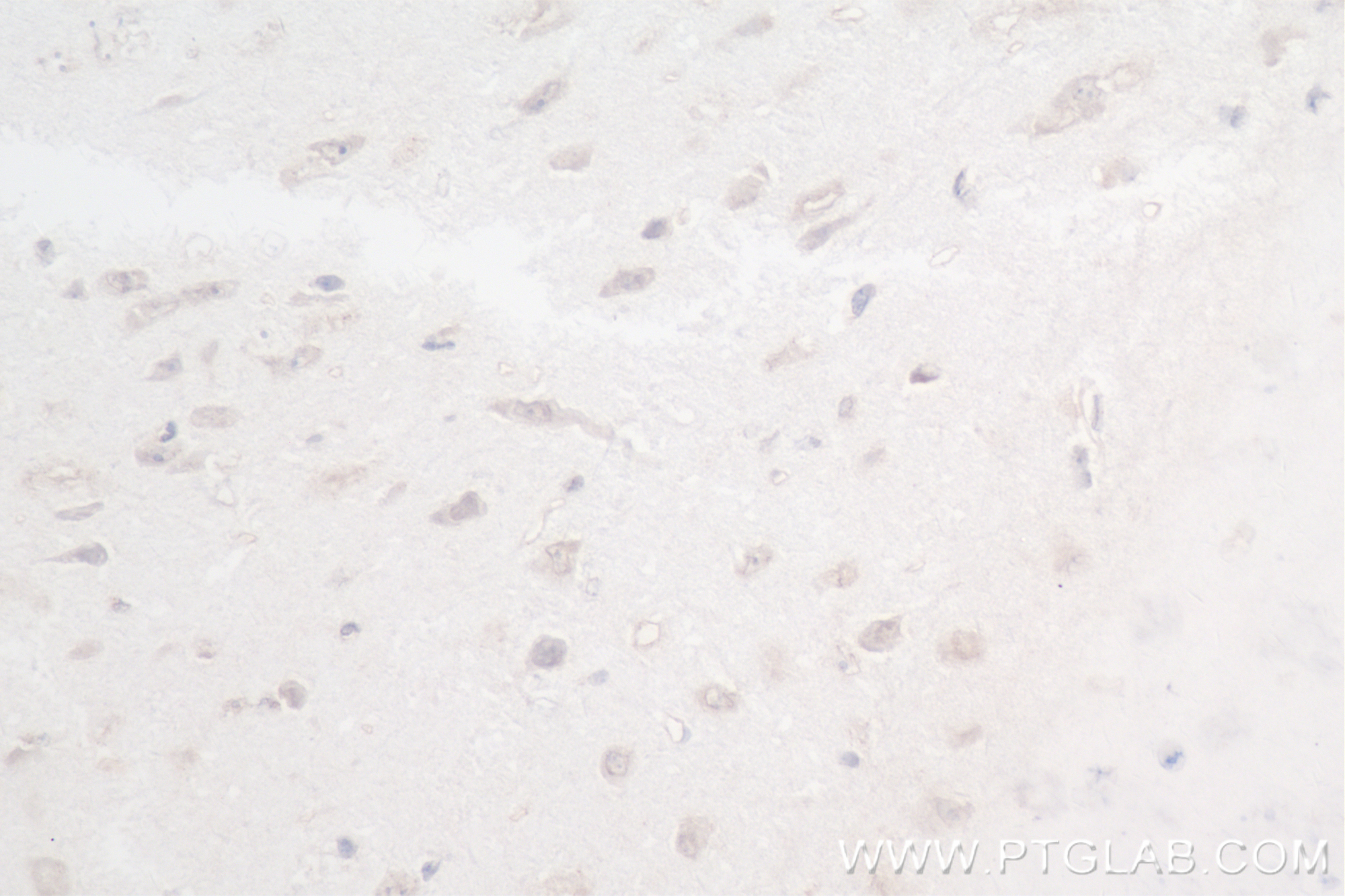IHC staining of mouse brain using 83608-5-RR (same clone as 83608-5-PBS)