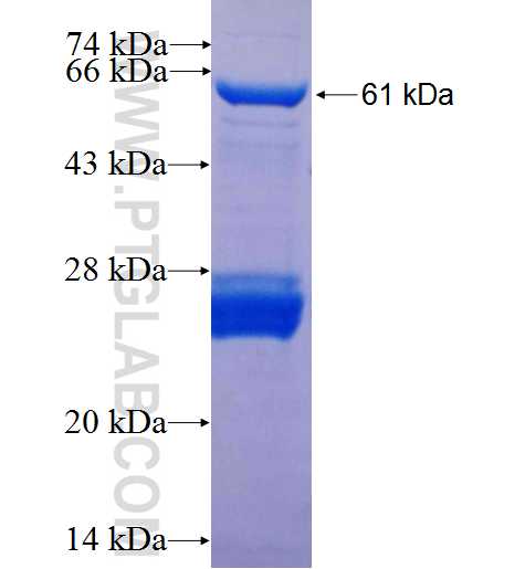 ATM fusion protein Ag25909 SDS-PAGE