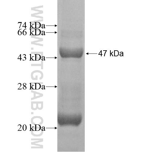 ATM fusion protein Ag15123 SDS-PAGE