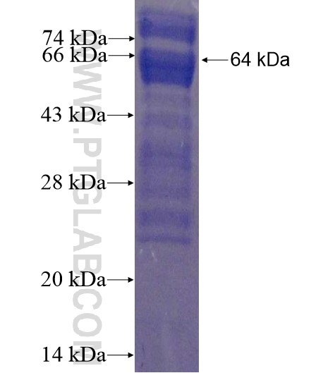 ATMIN fusion protein Ag15810 SDS-PAGE