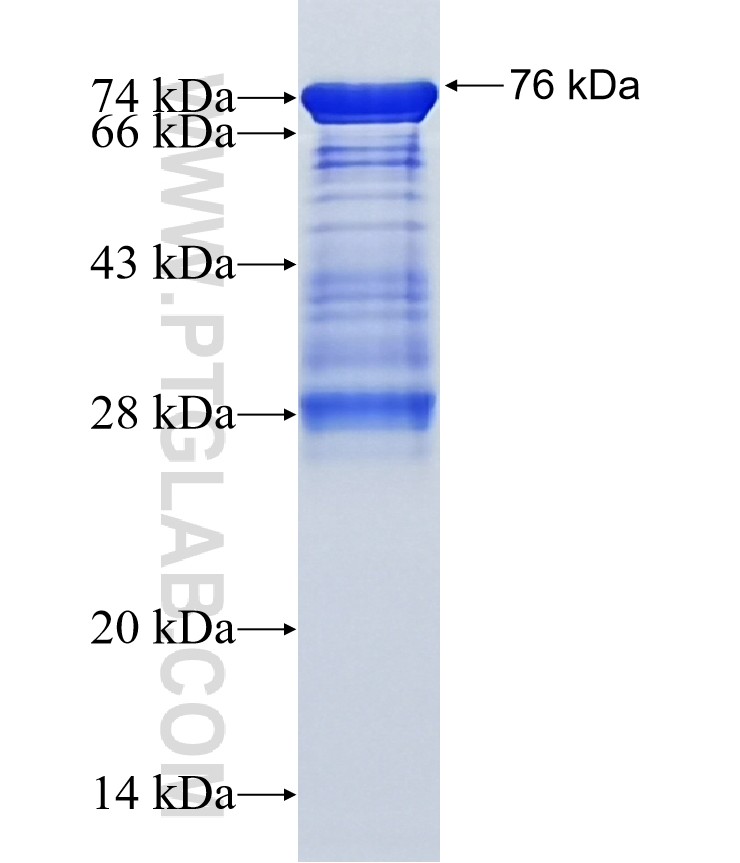 ATMIN fusion protein Ag15810 SDS-PAGE ATMIN fusion protein Ag15810 SDS-PAGE