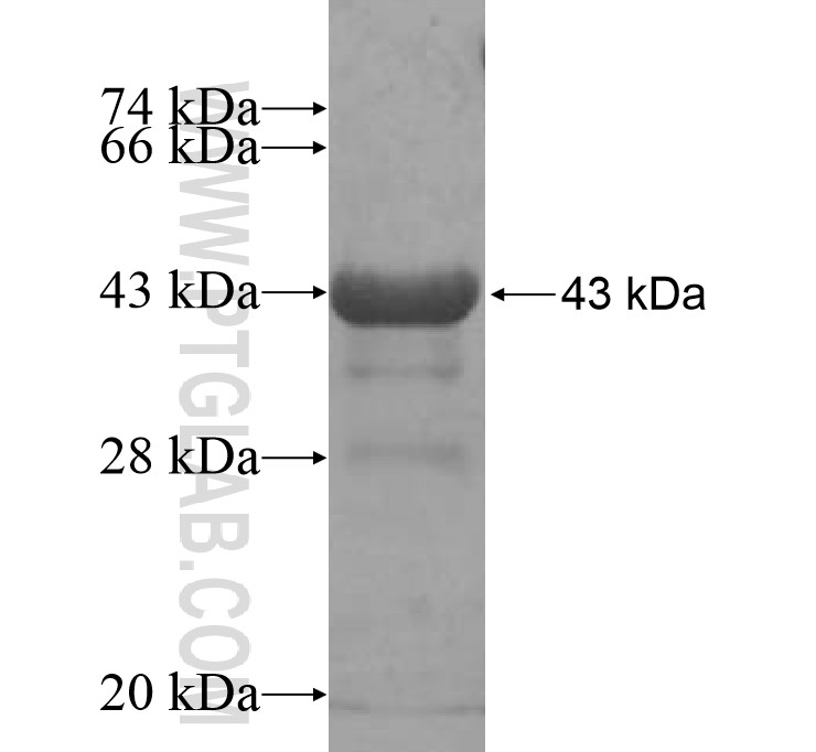 ATMPK8 fusion protein Ag14397 SDS-PAGE ATMPK8 fusion protein Ag14397 SDS-PAGE