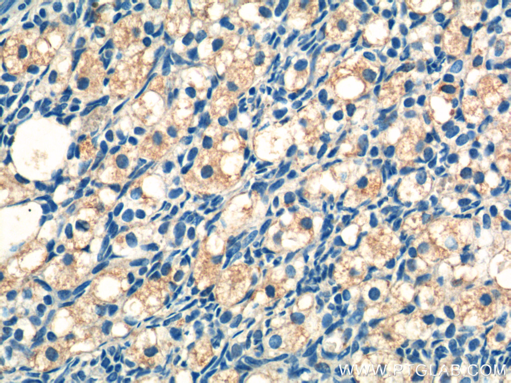 IHC staining of human ovary using 19243-1-AP