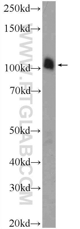 WB analysis of mouse testis using 19243-1-AP