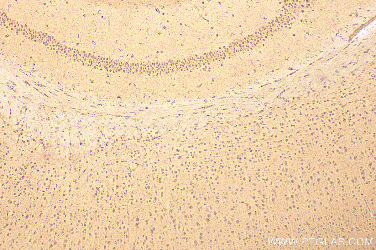 Immunohistochemical analysis of paraffin-embedded mouse brain tissue slide using 21215-1-AP (ATOH1 antibody) at dilution of 1:200 (under 10x lens). Heat mediated antigen retrieval with Tris-EDTA buffer (pH 9.0). IHC staining of mouse brain using 21215-1-AP