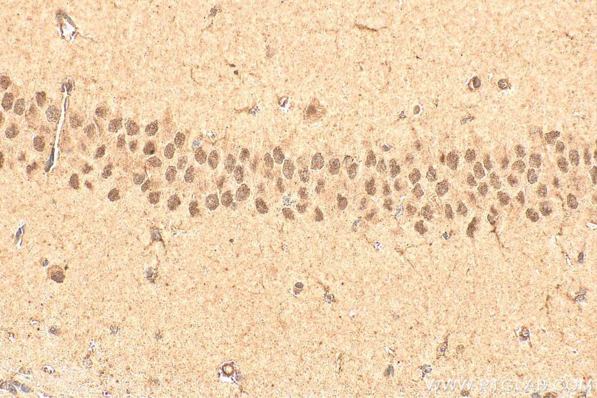 Immunohistochemical analysis of paraffin-embedded mouse brain tissue slide using 21215-1-AP (ATOH1 antibody) at dilution of 1:200 (under 40x lens). Heat mediated antigen retrieval with Tris-EDTA buffer (pH 9.0). IHC staining of mouse brain using 21215-1-AP