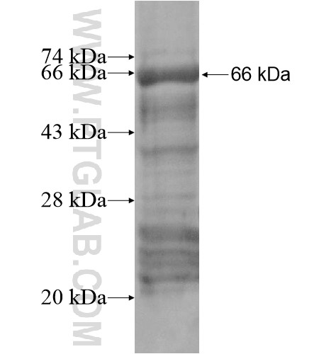 ATOH1 fusion protein Ag15615 SDS-PAGE