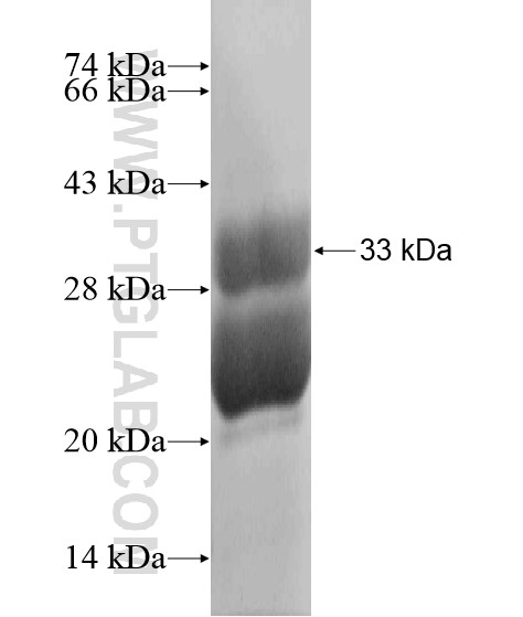 ATOH7 fusion protein Ag19967 SDS-PAGE ATOH7 fusion protein Ag19967 SDS-PAGE