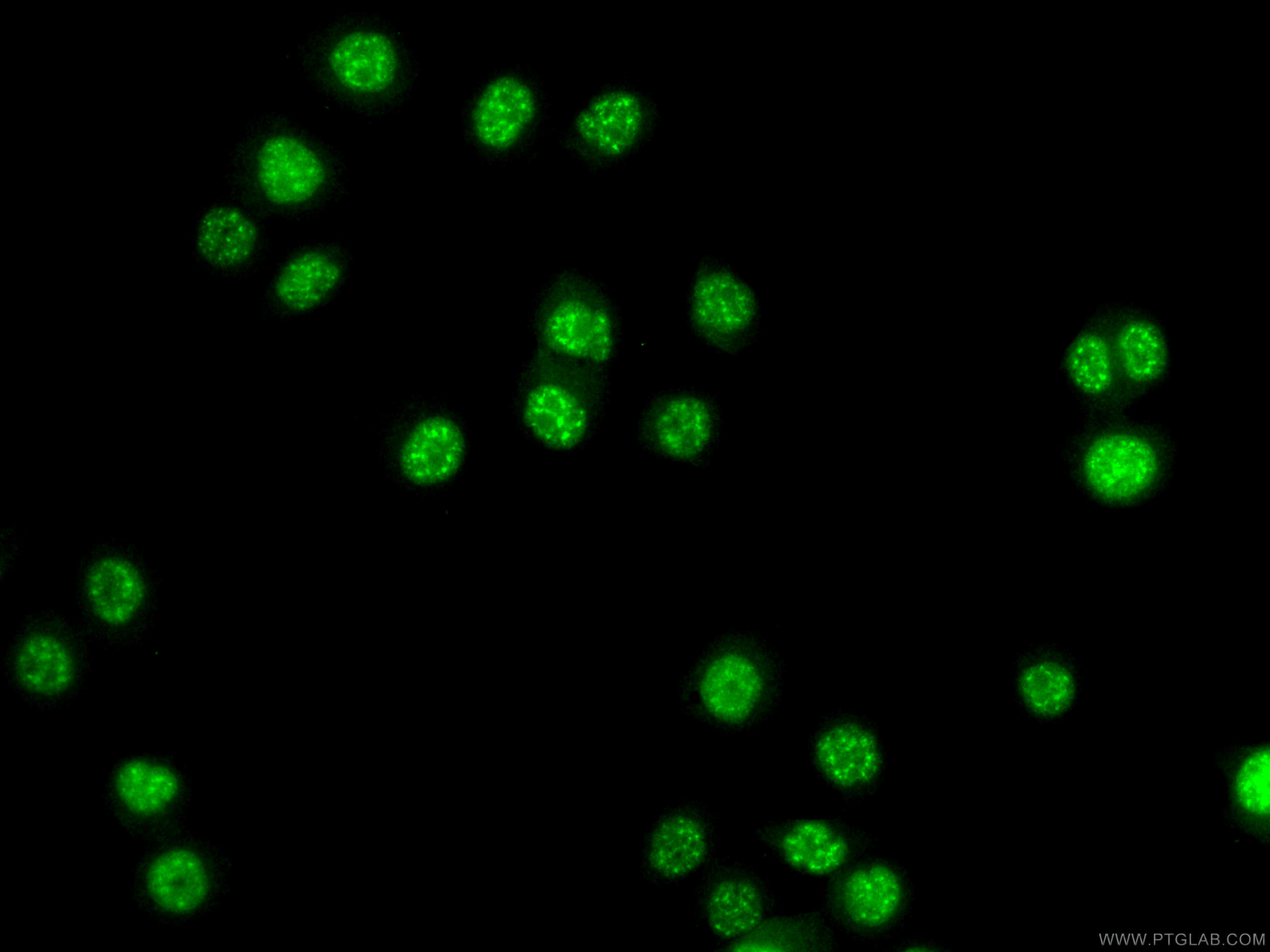 IF Staining of PC-3 using 22641-1-AP