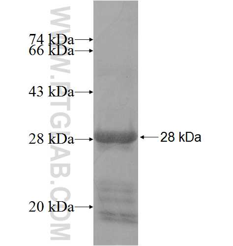 ATP10A fusion protein Ag10039 SDS-PAGE