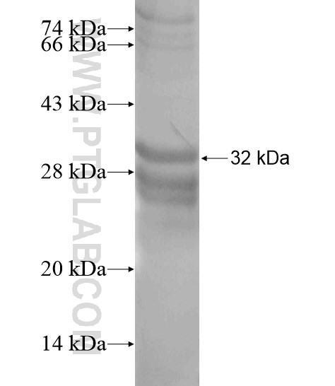 ATP11C fusion protein Ag20153 SDS-PAGE ATP11C fusion protein Ag20153 SDS-PAGE