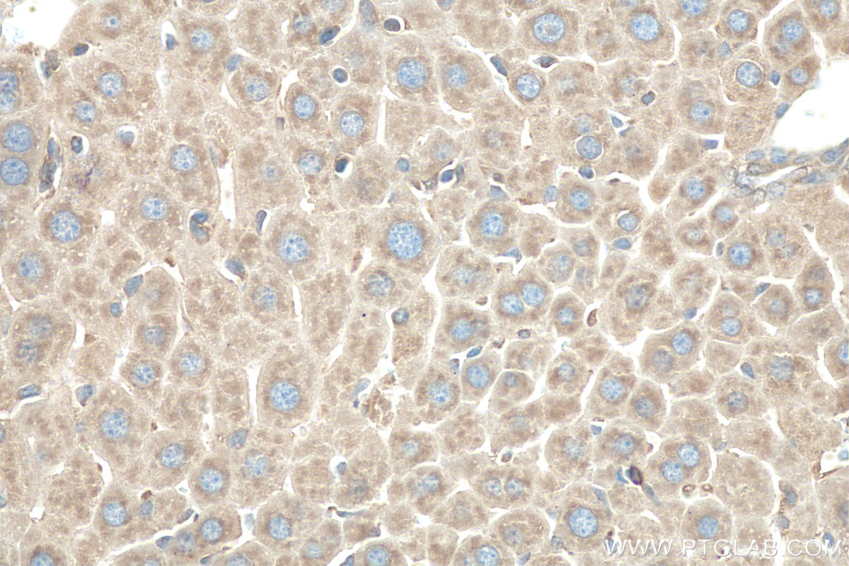 IHC staining of mouse liver using 16244-1-AP