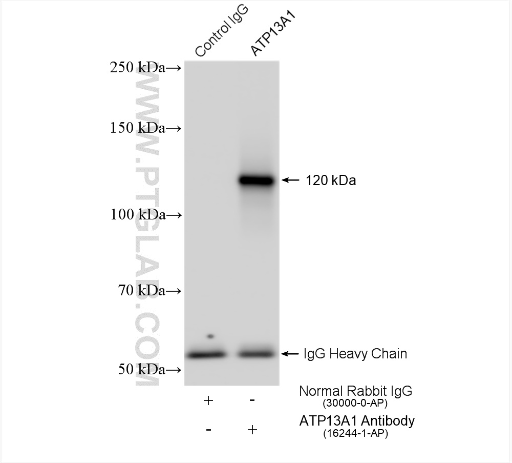 IP experiment of HeLa using 16244-1-AP