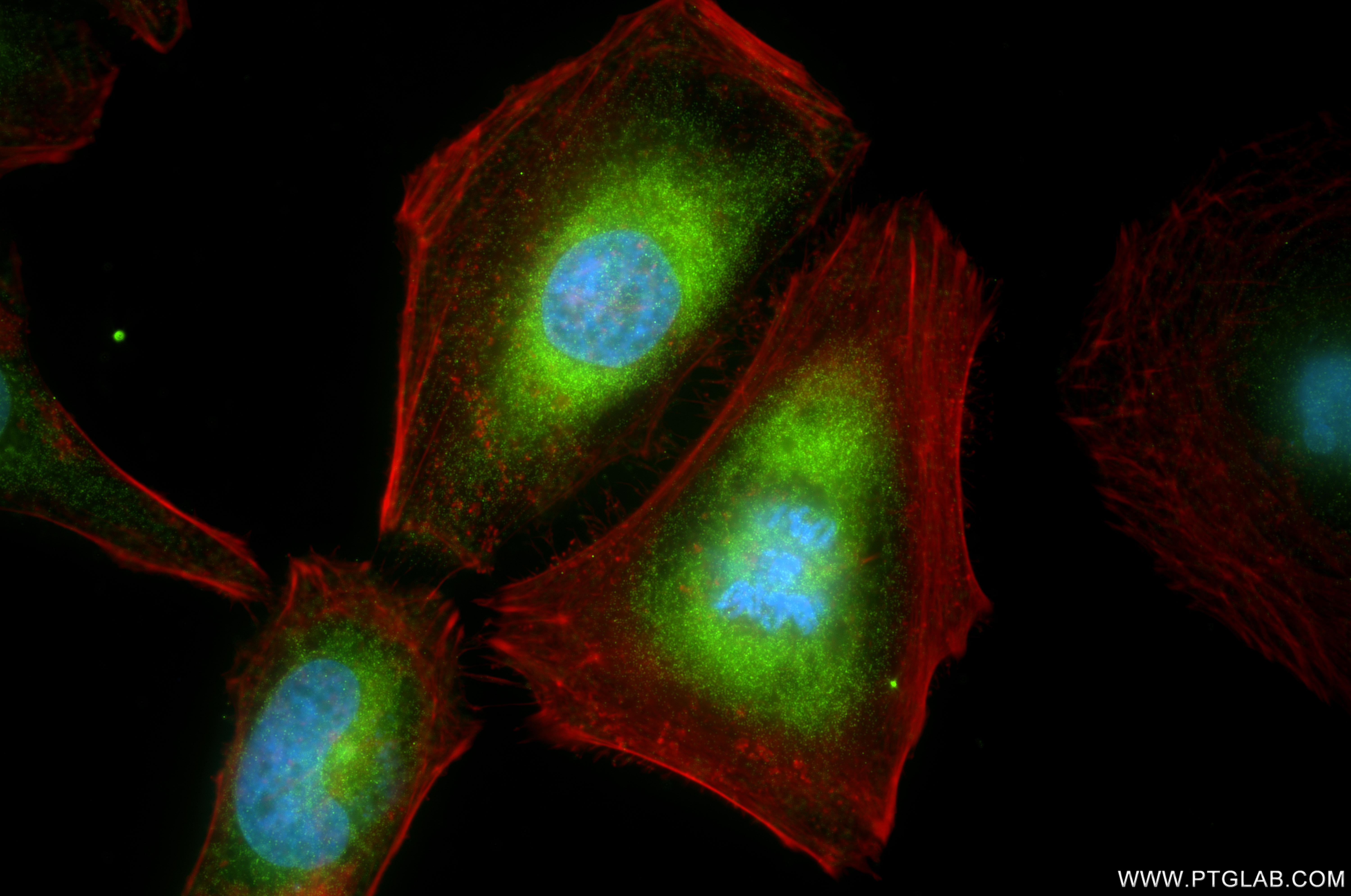 IF Staining of HeLa using 86762-3-RR IF Staining of HeLa using 86762-3-RR