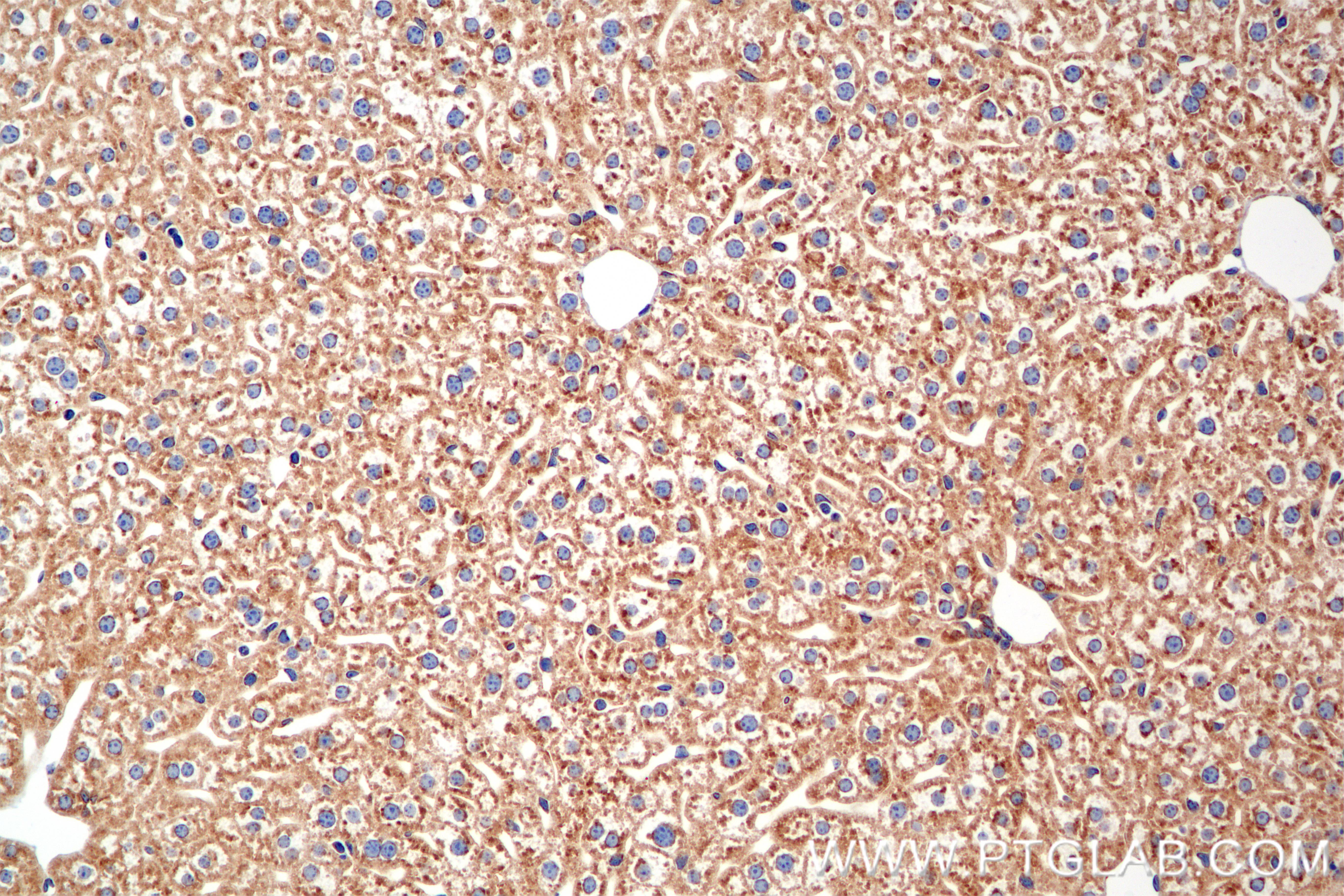 IHC staining of mouse liver using 86762-3-RR IHC staining of mouse liver using 86762-3-RR