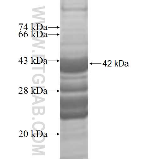 ATP13A1 fusion protein Ag9174 SDS-PAGE
