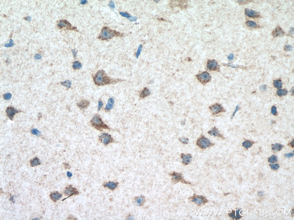 IHC staining of mouse brain using 19141-1-AP