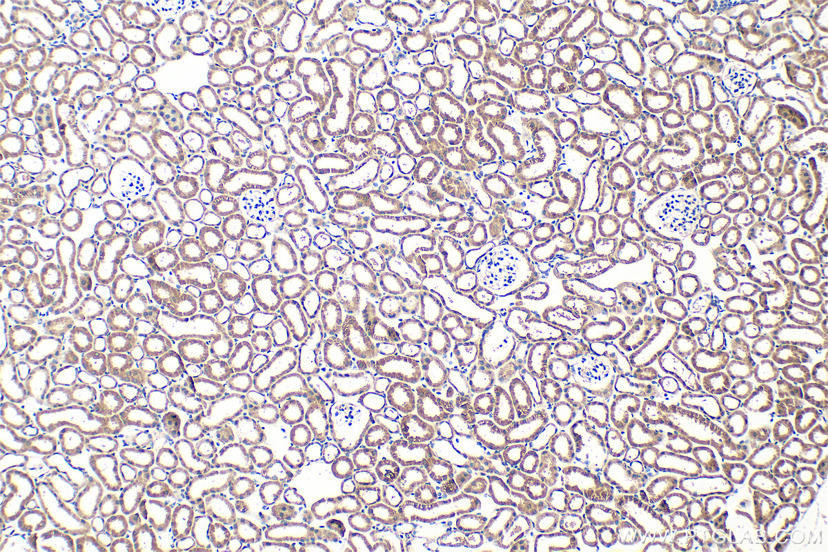 IHC staining of mouse kidney using 24676-1-AP