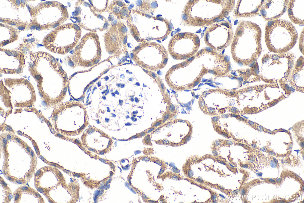 IHC staining of mouse kidney using 24676-1-AP