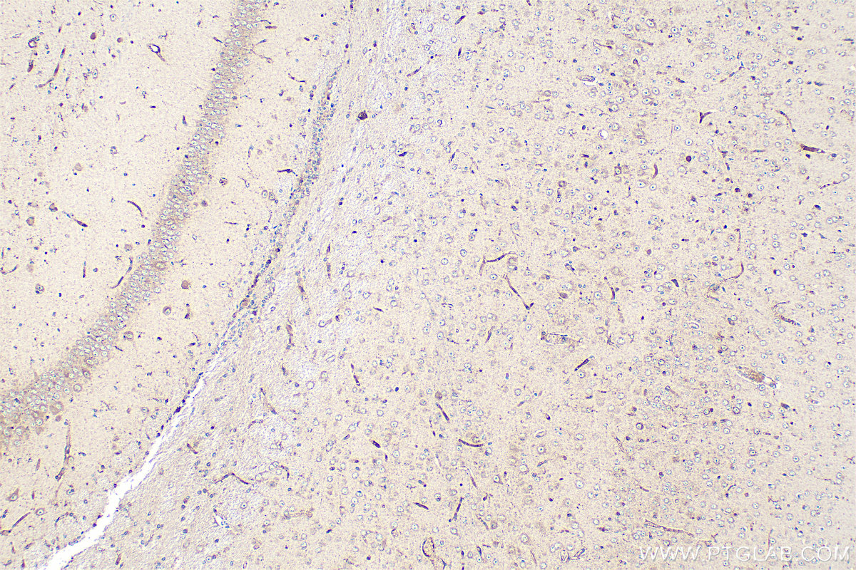 IHC staining of mouse brain using 24676-1-AP