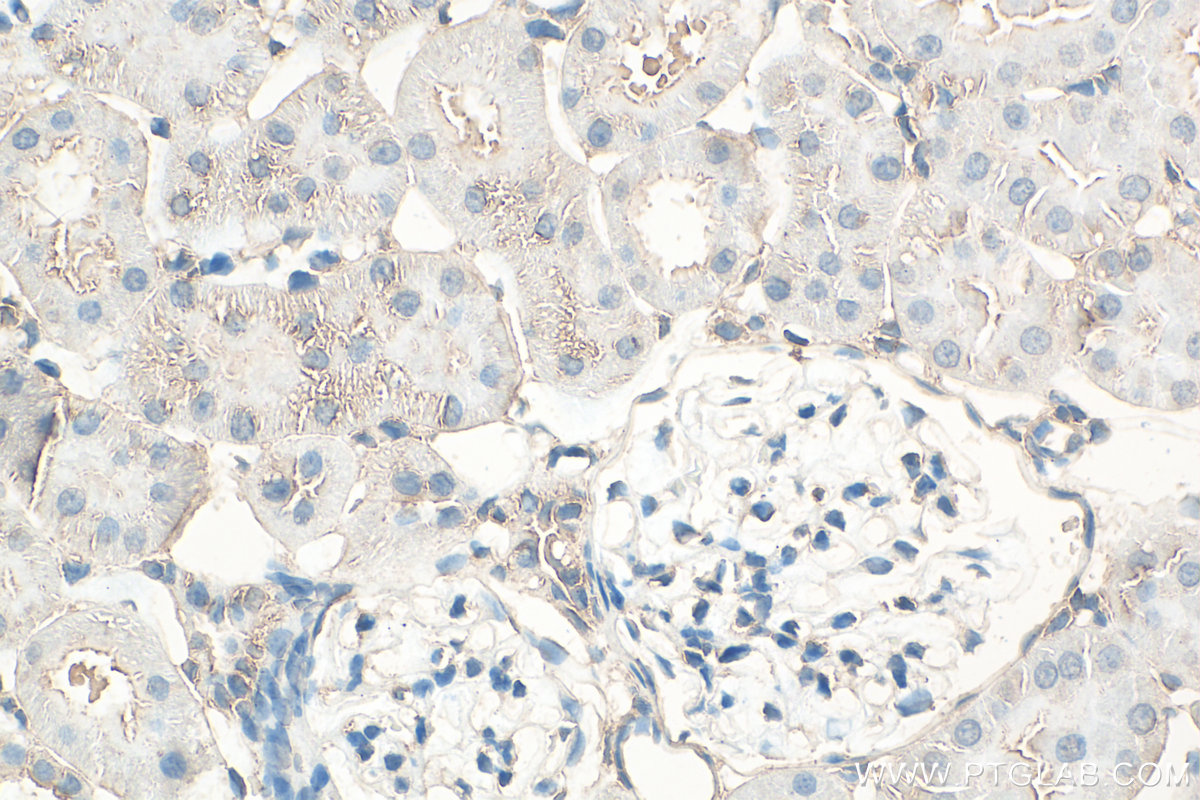 Immunohistochemical analysis of paraffin-embedded rat kidney tissue slide using Biotin-24676 (ATP13A5 antibody) at dilution of 1:200 (under 40x lens). Heat mediated antigen retrieval with Tris-EDTA buffer (pH 9.0). IHC staining of rat kidney using Biotin-24676