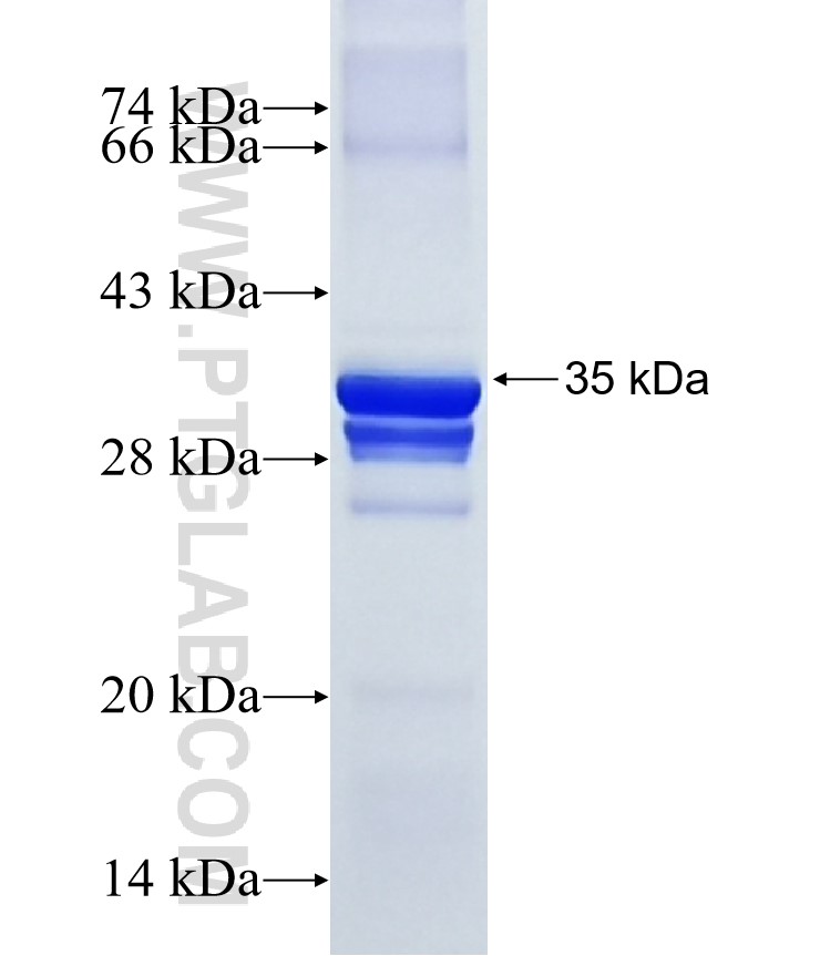 ATP13A5 fusion protein Ag20320 SDS-PAGE ATP13A5 fusion protein Ag20320 SDS-PAGE