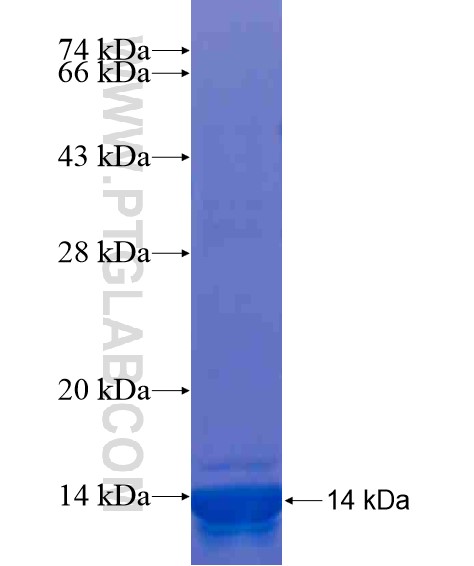 ATP13A5 fusion protein Ag20337 SDS-PAGE ATP13A5 fusion protein Ag20337 SDS-PAGE