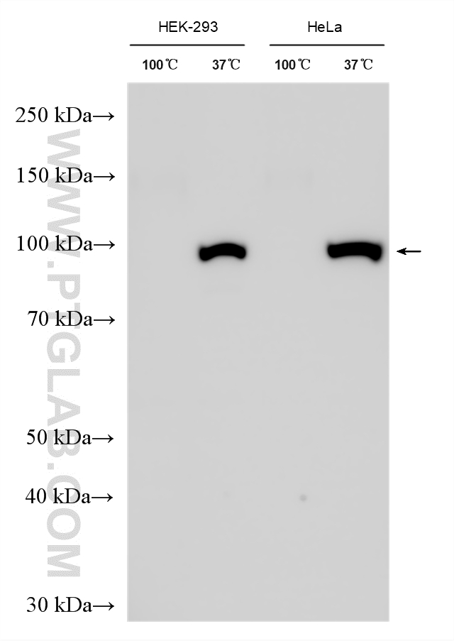 Various lysates were subjected to SDS PAGE followed by western blot with 14418-1-AP (ATP1A1 antibody) at dilution of 1:40000 incubated at room temperature for 1.5 hours. WB analysis using 14418-1-AP