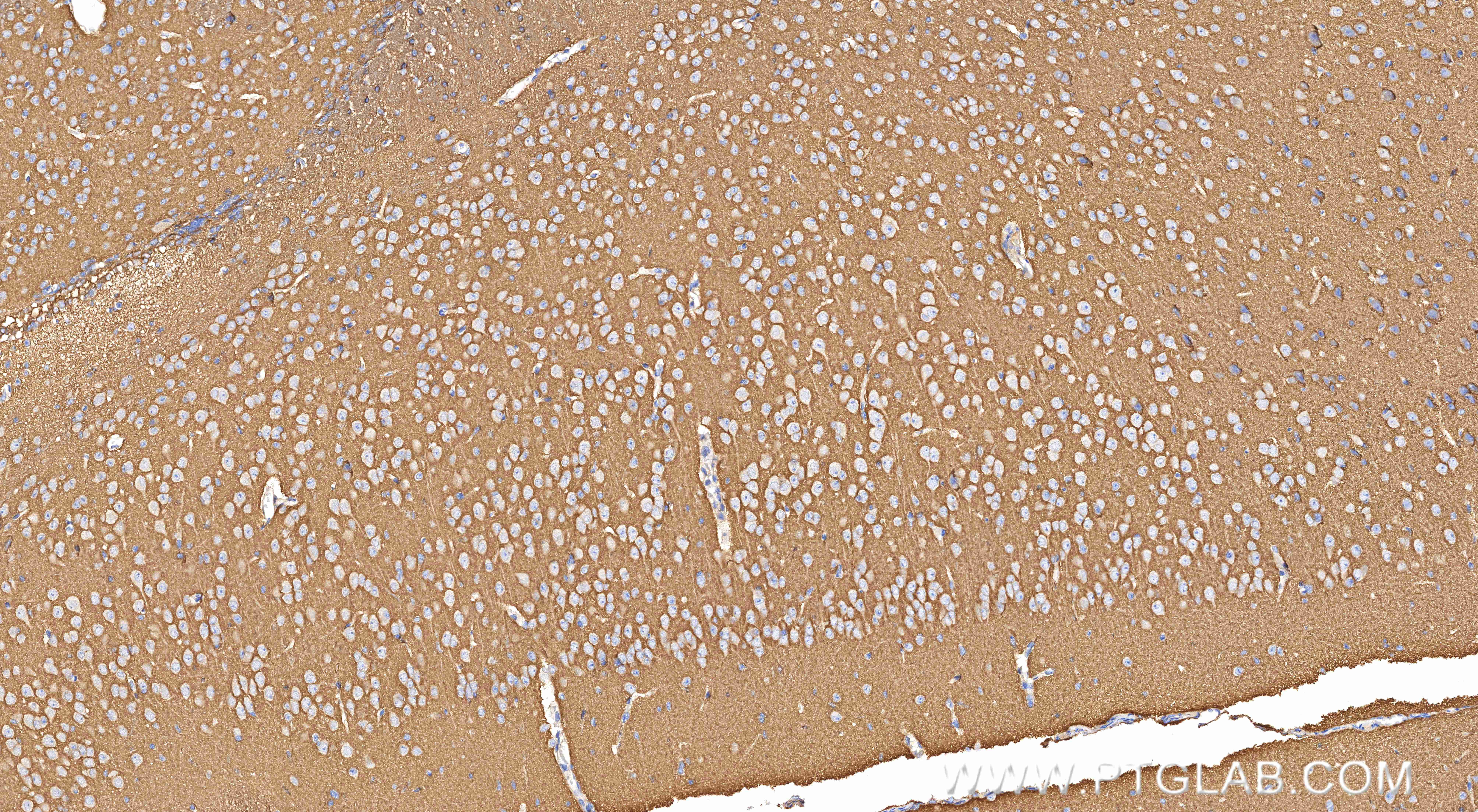 IHC staining of mouse brain using 83191-6-RR (same clone as 83191-6-PBS)