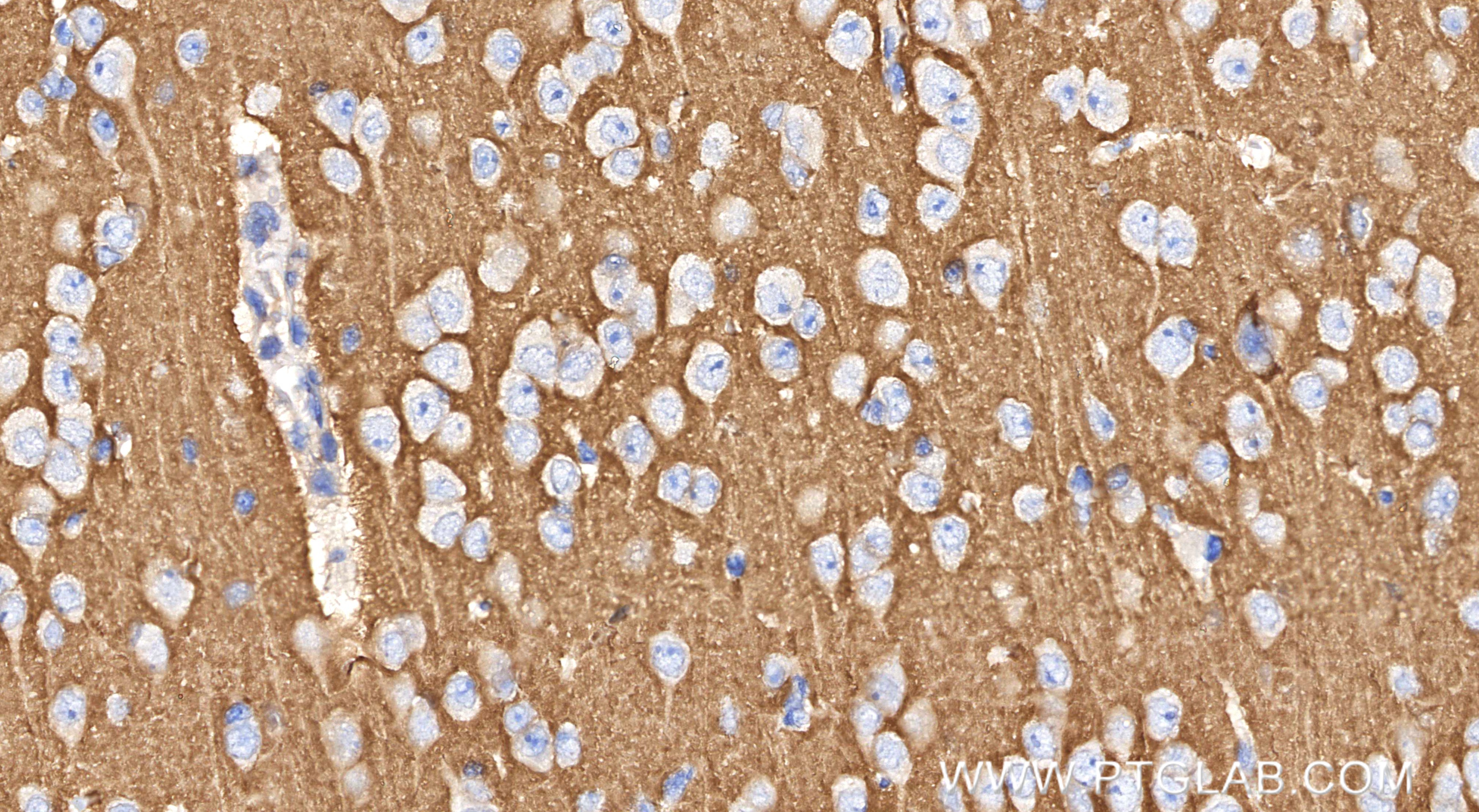 IHC staining of mouse brain using 83191-6-RR (same clone as 83191-6-PBS)