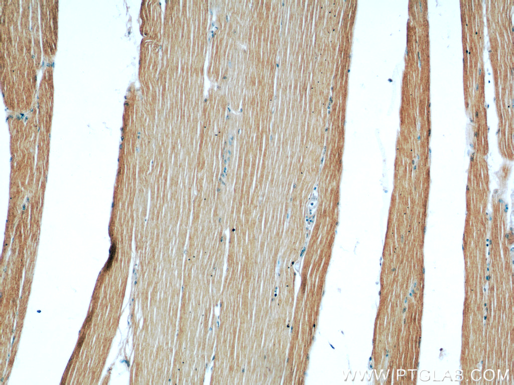IHC staining of human skeletal muscle using 55179-1-AP