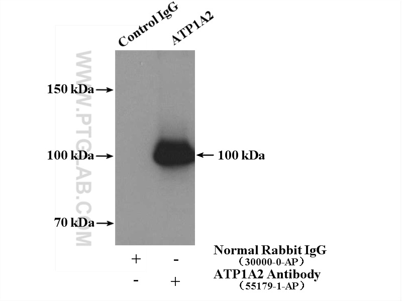 IP experiment of mouse brain using 55179-1-AP