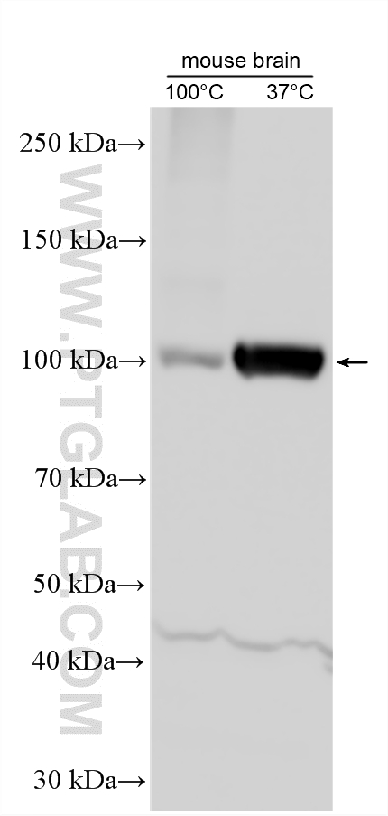 Various lysates were subjected to SDS PAGE followed by western blot with <a class='green' href='/productredirect?CatalogNo=55179-1-AP' target='_blank'>55179-1-AP</a> (ATP1A2-Specific antibody) at dilution of 1:1000 incubated at room temperature for 1.5 hours. This data was developed using the same antibody clone with 55179-1-PBS in a different storage buffer formulation. WB analysis using 55179-1-AP (same clone as 55179-1-PBS)