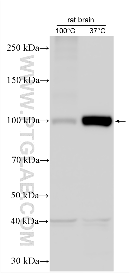 Various lysates were subjected to SDS PAGE followed by western blot with <a class='green' href='/productredirect?CatalogNo=55179-1-AP' target='_blank'>55179-1-AP</a> (ATP1A2-Specific antibody) at dilution of 1:1000 incubated at room temperature for 1.5 hours. This data was developed using the same antibody clone with 55179-1-PBS in a different storage buffer formulation. WB analysis using 55179-1-AP (same clone as 55179-1-PBS)