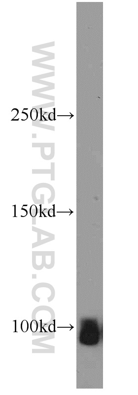 WB analysis of mouse brain using 55179-1-AP