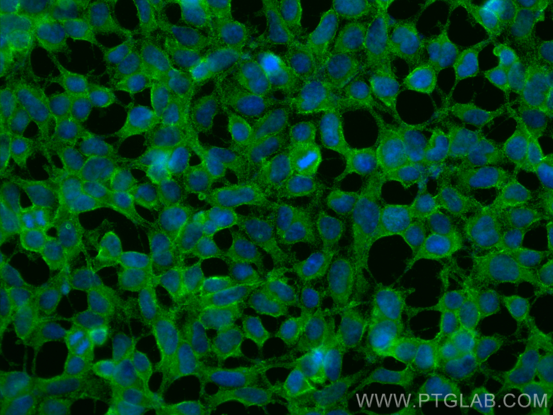 IF Staining of HEK-293 using 68505-1-Ig (same clone as 68505-1-PBS)